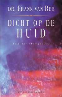 Dicht op de huid