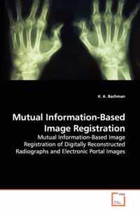 Mutual Information-Based Image Registration