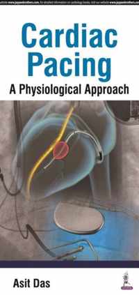 Cardiac Pacing A Physiological Approach