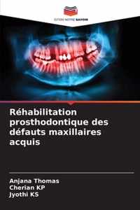 Rehabilitation prosthodontique des defauts maxillaires acquis