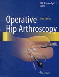 Operative Hip Arthroscopy