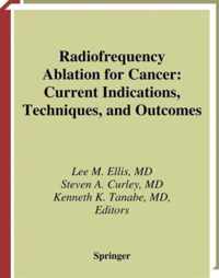 Radiofrequency Ablation for Cancer