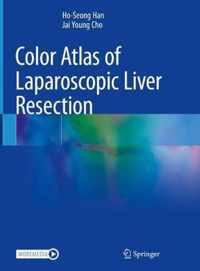 Color Atlas of Laparoscopic Liver Resection