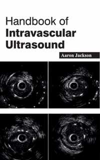 Handbook of Intravascular Ultrasound