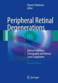 Peripheral Retinal Degenerations