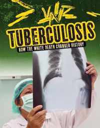 Tuberculosis