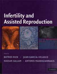 Infertility and Assisted Reproduction