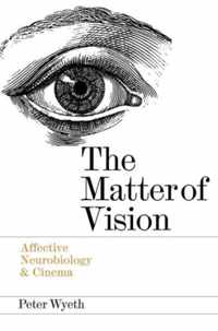 The Matter of Vision