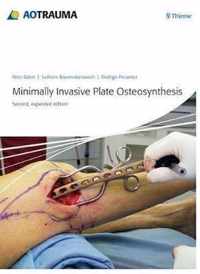 Minimally Invasive Plate Ostheosynthesis (MIPO)