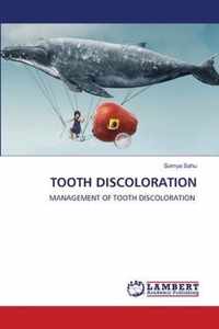 Tooth Discoloration