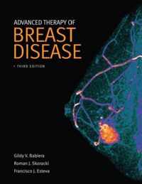 Advanced Therapy of Breast Disease