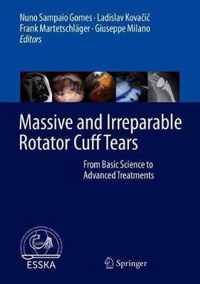 Massive and Irreparable Rotator Cuff Tears