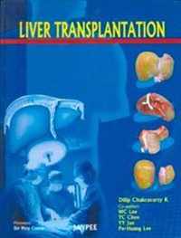 Liver Transplantation