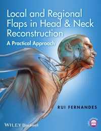 Local and Regional Flaps in Head and Neck Reconstruction