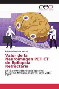 Valor de la Neuroimagen PET CT de Epilepsia Refractaria