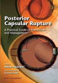 Posterior Capsular Rupture