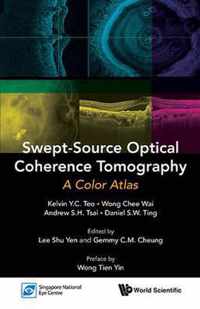 Swept-source Optical Coherence Tomography