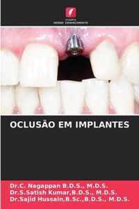 Oclusao Em Implantes