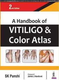 A Handbook of Vitiligo & Color Atlas