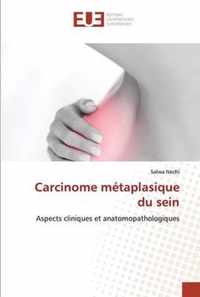 Carcinome metaplasique du sein