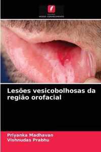 Lesoes vesicobolhosas da regiao orofacial