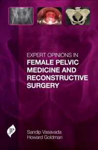 Expert Opinions in Female Pelvic Medicine and Reconstructive Surgery