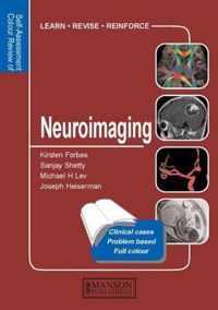 Neuroimaging