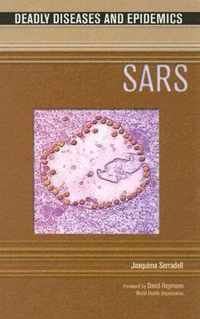 Sars