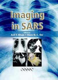 Imaging in SARS