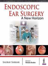 Endoscopic Ear Surgery