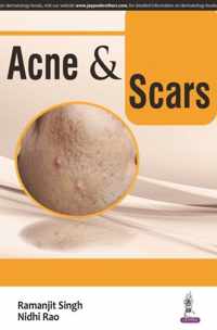 Acne & Scars