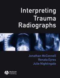 Interpreting Trauma Radiographs