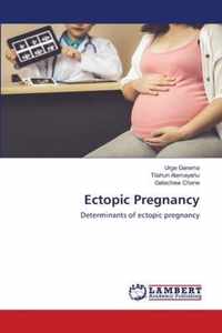 Ectopic Pregnancy