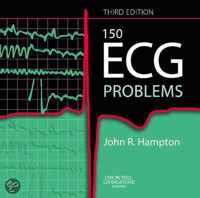 150 ECG Problems