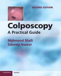 Colposcopy