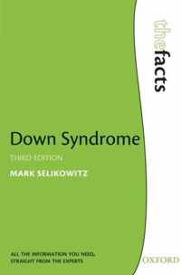 Down Syndrome