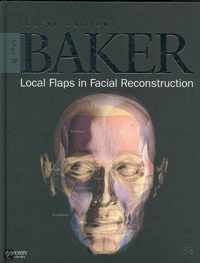 Local Flaps in Facial Reconstruction