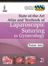 State-of-the-Art Atlas and Textbook of Laparoscopic Suturing in Gynecology