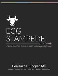 ECG Stampede