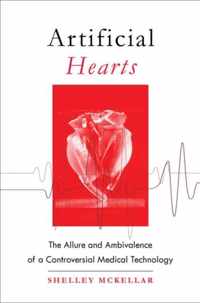 Artificial Hearts - The Allure and Ambivalence of a Controversial Medical Technology