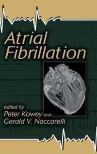 Atrial Fibrillation