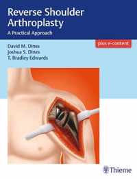 Reverse Shoulder Arthroplasty