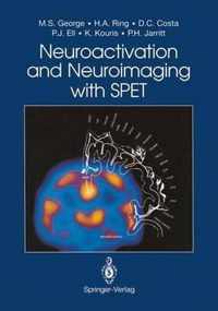 Neuroactivation and Neuroimaging with SPET