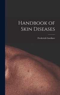 Handbook of Skin Diseases