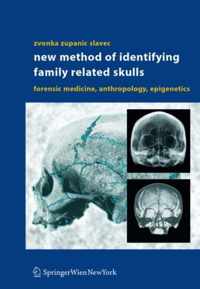 New Methods of Identifying Family Related Skulls