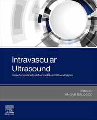 Intravascular Ultrasound