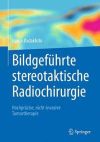 Bildgefuhrte stereotaktische Radiochirurgie