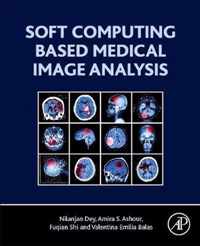 Soft Computing Based Medical Image Analysis