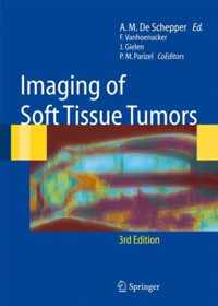 Imaging of Soft Tissue Tumors