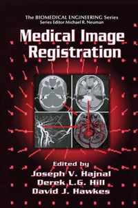 Medical Image Registration